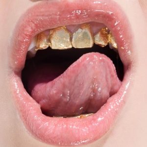 Golden teeth by Sylvie Blum, closeup of open mouth with goldplated teeth